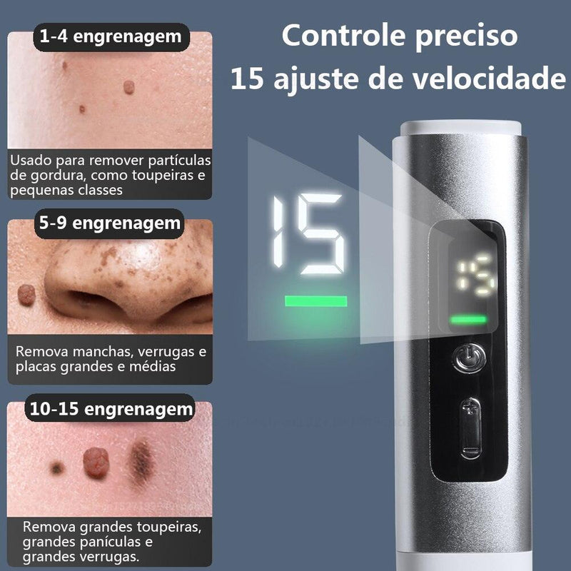 Inédito e Inovador: Removedor de Pintas e Verrugas